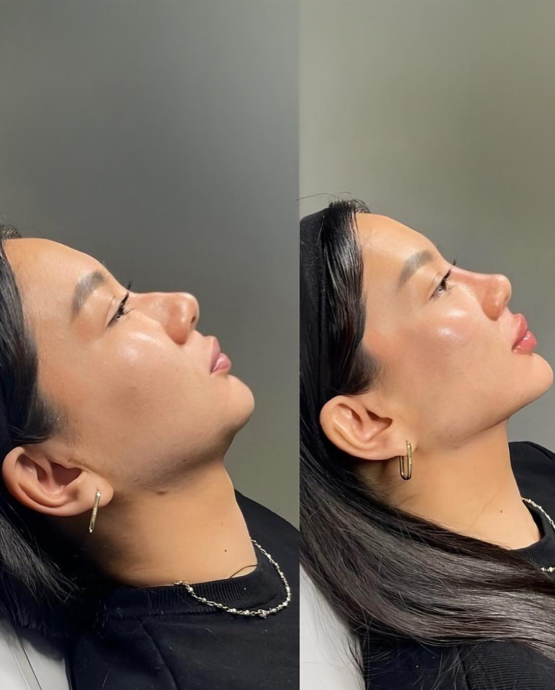 ✨ Face Sculpt Pro™