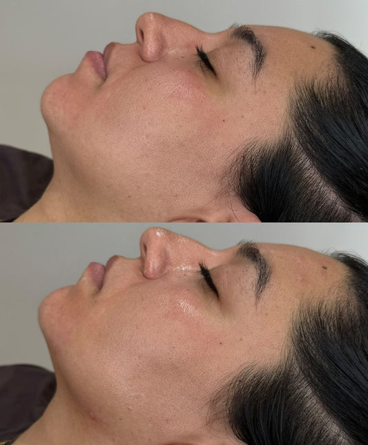 ✨ Face Sculpt Pro™