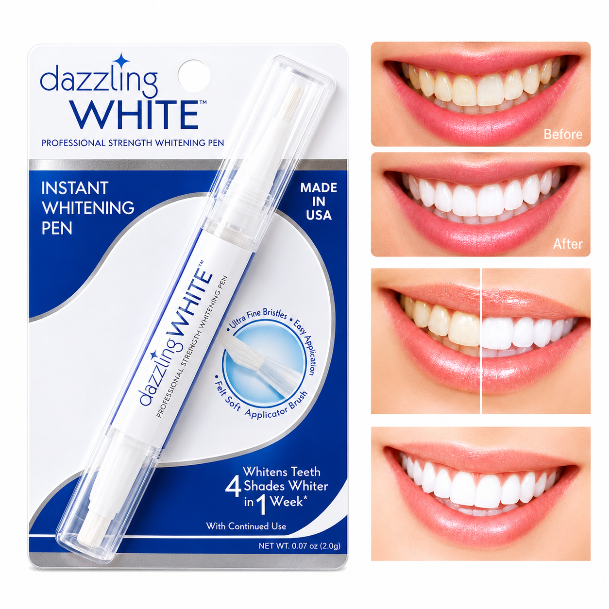 ✨😁 WhiteGlow Pen™
